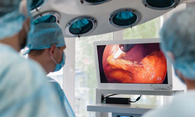 AUGMENTED REALITY IN ROBOTIC SURGERY: FIRST-IN-HUMAN WITH NVIDIA HOLOSCAN AND DELTATEC VIDEO SOLUTIONS